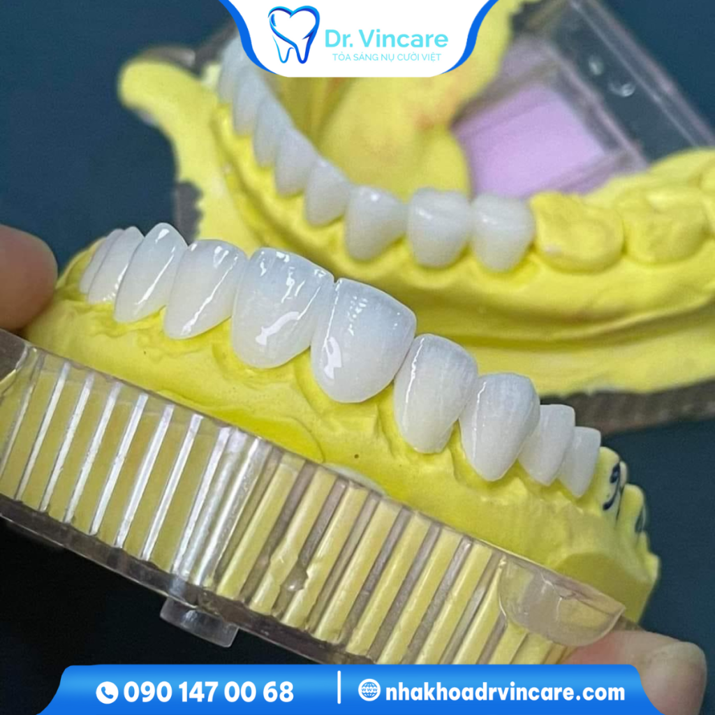 Tất tần tật về Làm răng sứ thẩm mỹ tại nha khoa Dr.Vincare