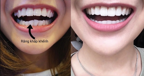 Nha khoa DR.VINCARE